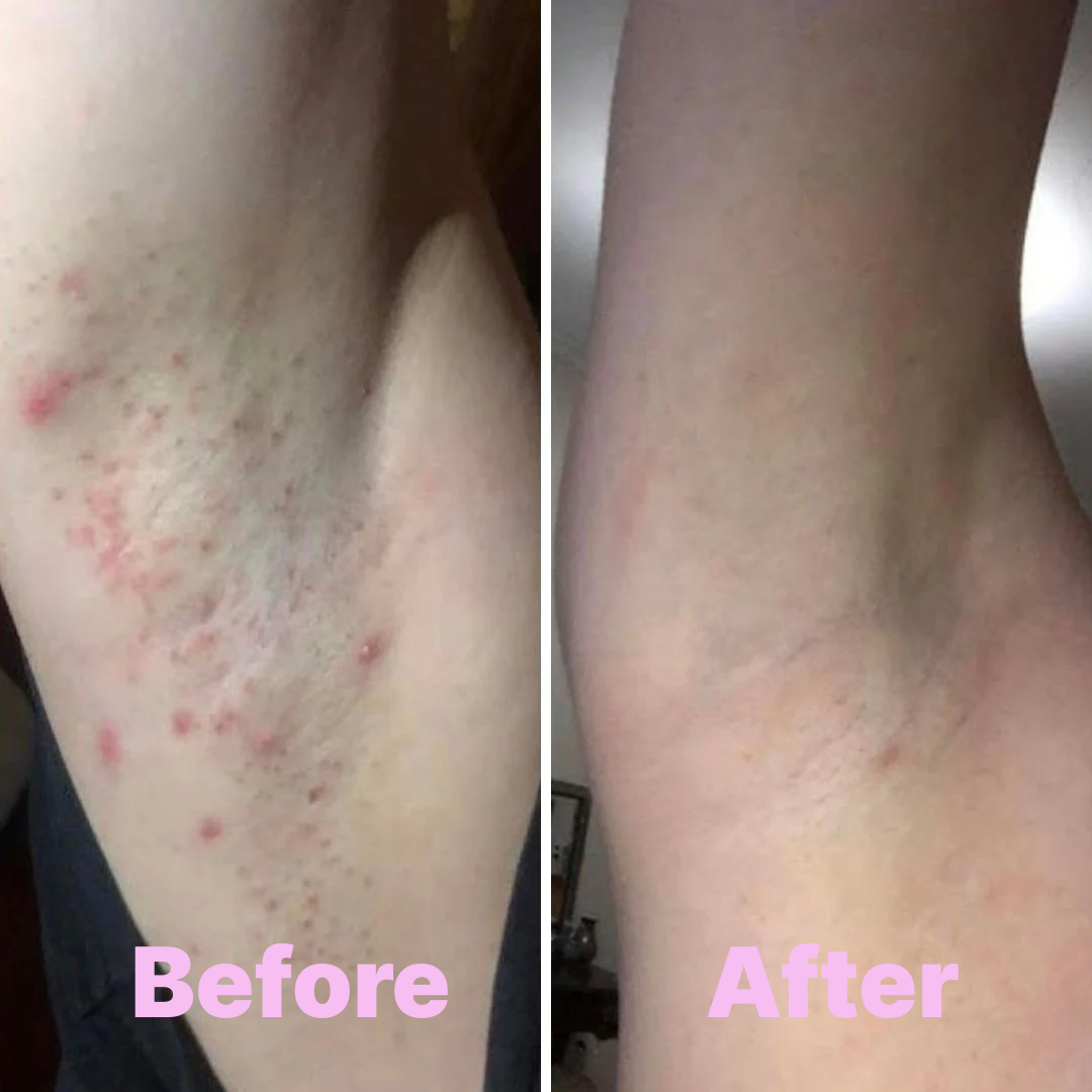 DermaRestore™ After Shave Oil